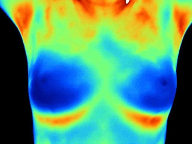 Thermogram of healthy breasts