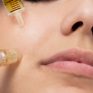 SkinPen® Microneedling with PRF