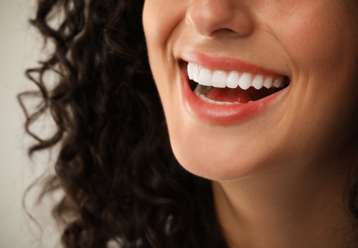Close-up of a woman smiling with natural movement around her mouth and cheeks